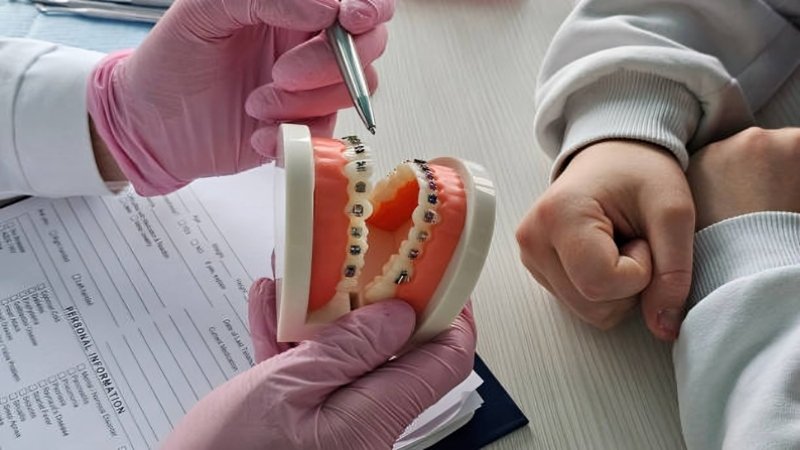 Questions to Ask Before Orthodontic Treatment Guide